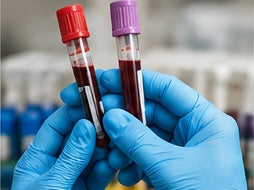 Blood Tests